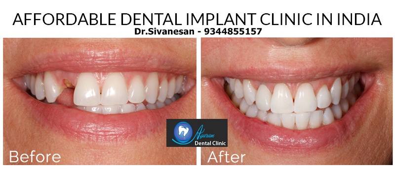 agaram dental