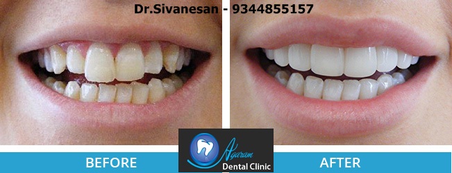 agaram dental