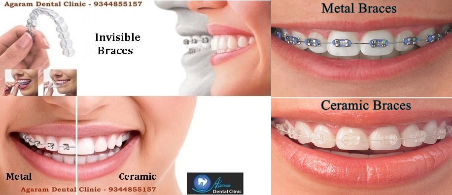 Dental Clinic in Madurai