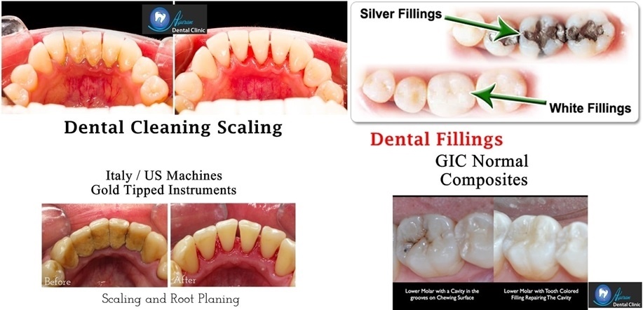 Dental Clinic in Madurai