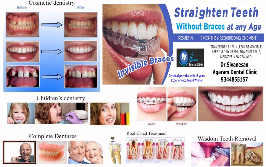 Flexible Dentures Madurai